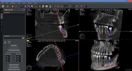 Owandy I-Max Touch 3D Ceph – Конусно-лучевой томограф 9х8