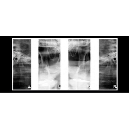 Planmeca ProOne - универсальный цифровой ортопантомограф