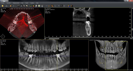 Owandy I-Max Touch 3D Ceph – Конусно-лучевой томограф 9х8