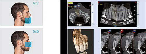 NewTom 2D/3D GO – Компьютерный томограф