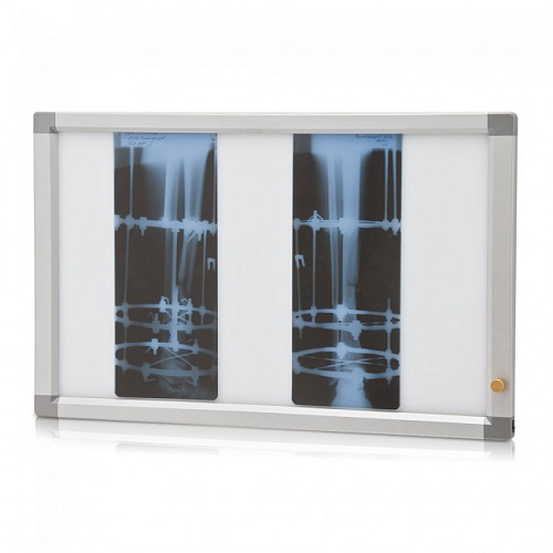 Армед Armed 2 - негатоскоп флуоресцентный двухкадровый